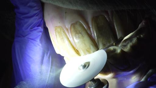 Auch Pferde müssen zum Zahnarzt