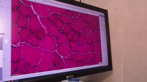 Biozentrum gelingt Durchbruch bei seltener Muskelerkrankung